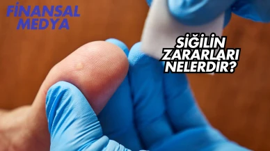 Siğilin Zararları Nelerdir?