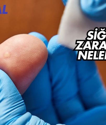 Siğilin Zararları Nelerdir?